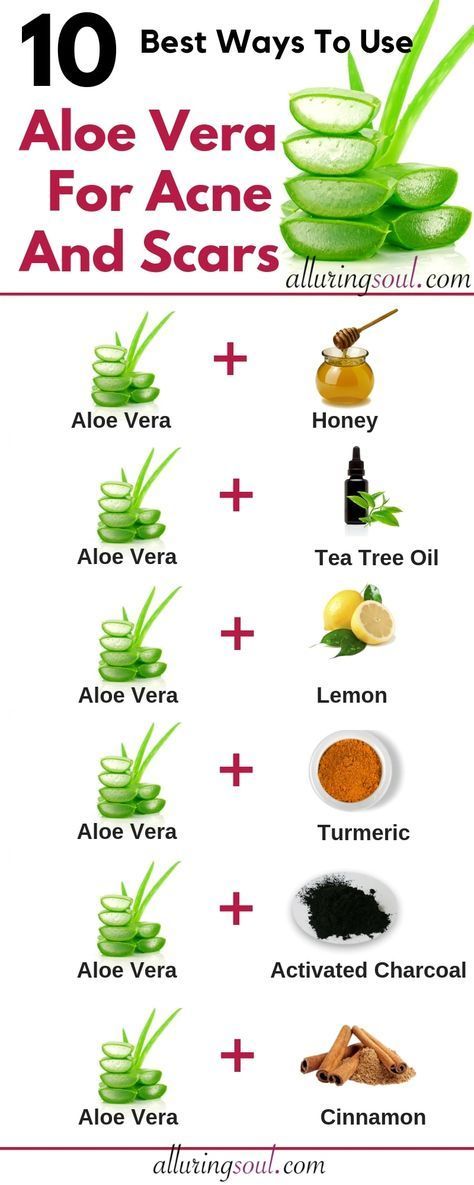 Aloe Vera For Acne - 10 Ways To Treat Acne And Scars | Alluring Soul - Aloe Vera For Acne - 10 Ways To Treat Acne And Scars | Alluring Soul -   10 diy Face Mask aloe vera ideas