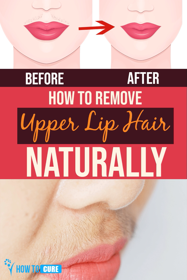 How To Remove Upper Lip Hair Naturally - HowToCure - How To Remove Upper Lip Hair Naturally - HowToCure -   12 beauty Natural pink ideas