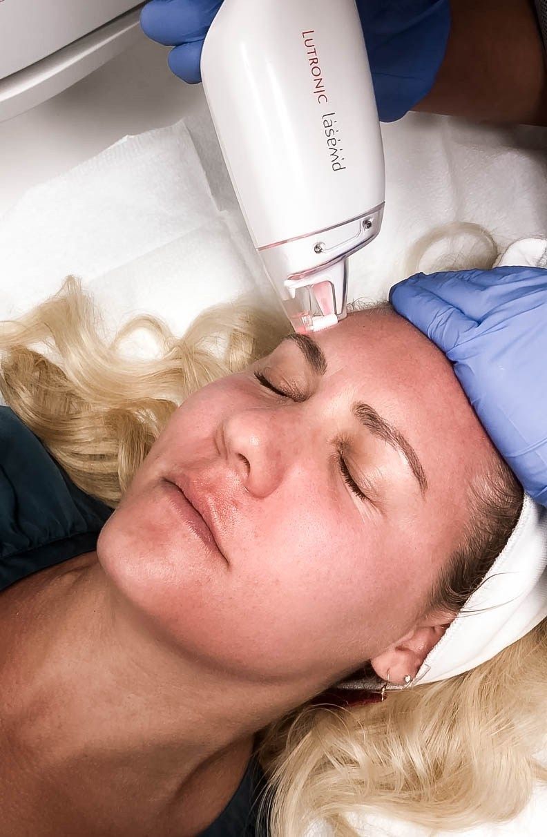 LaseMD Laser Facial Treatment - Have Need Want - LaseMD Laser Facial Treatment - Have Need Want -   14 beauty Treatments facial ideas