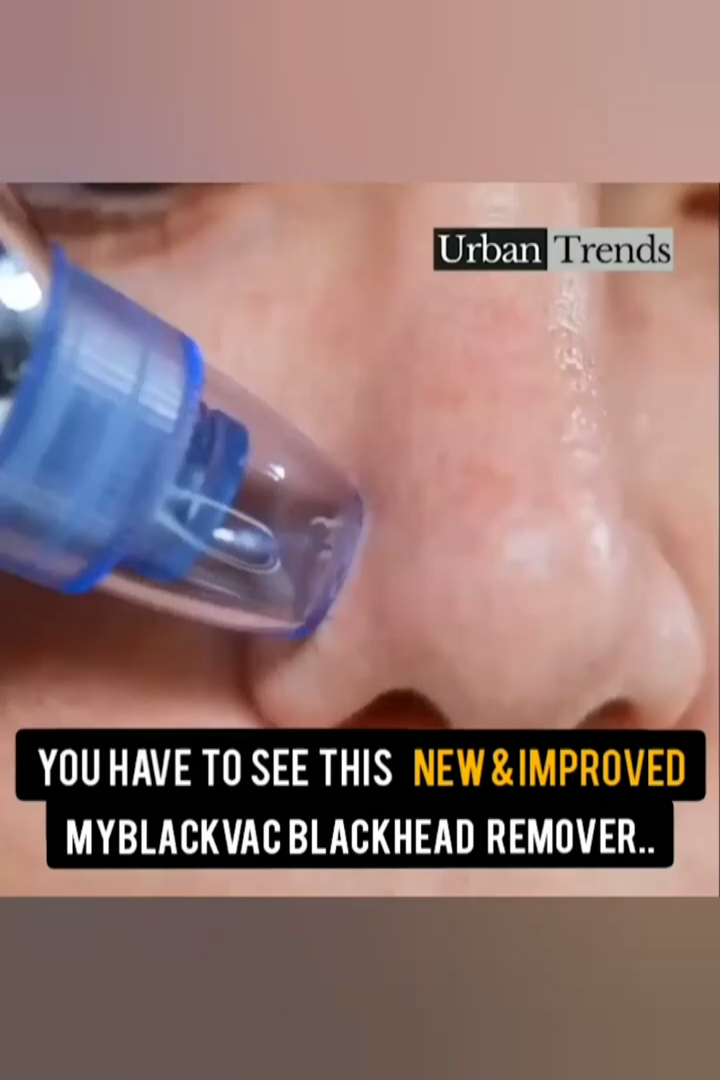 Black Head Remover - 40% Discount. - Black Head Remover - 40% Discount. -   6 beauty Skin hacks ideas