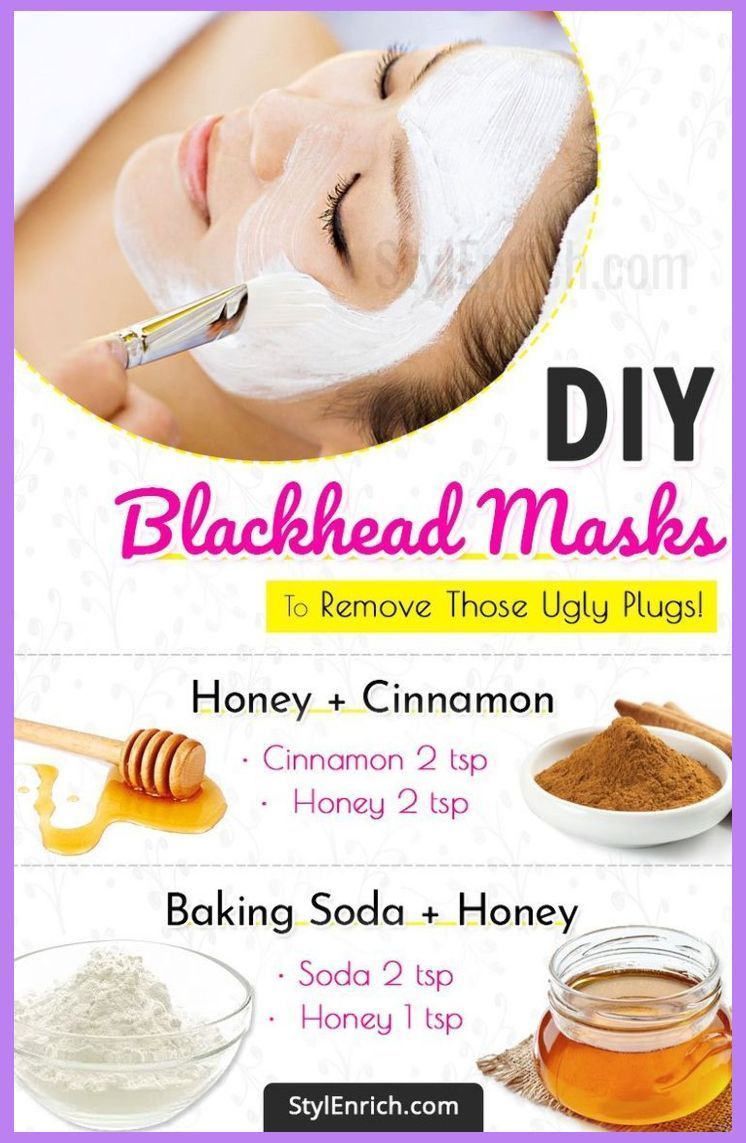Blackhead Remover - Best Natural Ways to Remove Acne For Good | Lemon For Blackheads Overnigh... - Blackhead Remover - Best Natural Ways to Remove Acne For Good | Lemon For Blackheads Overnigh... -   14 beauty Face mask ideas