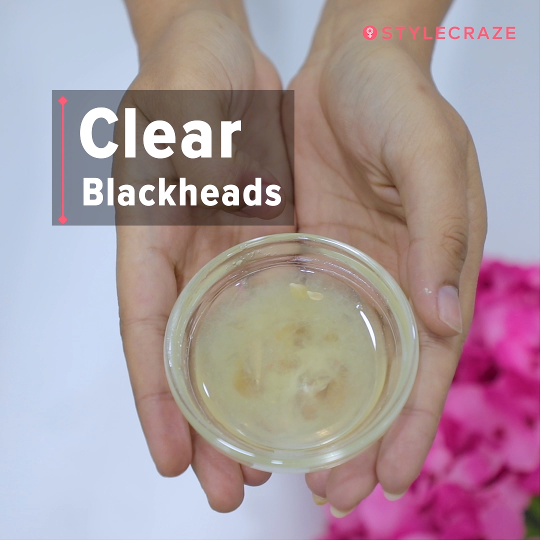 How To Remove Blackheads On The Nose - How To Remove Blackheads On The Nose -   DIY Beauty hacks and videos