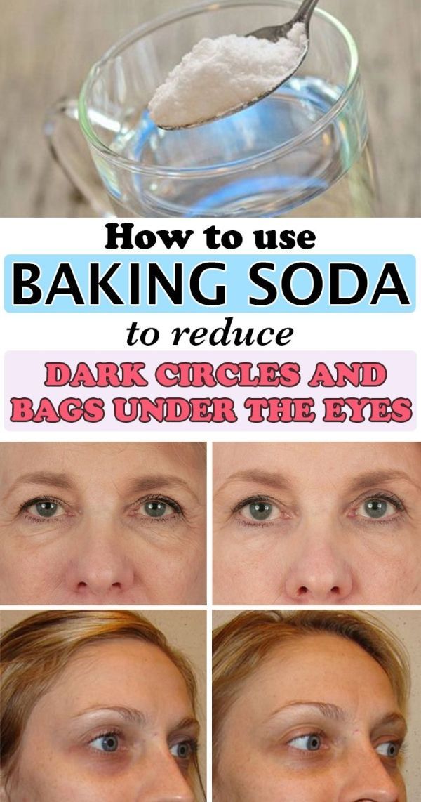 How to use baking soda to reduce dark circles and bags under the eyes - WifeMommyWoman - How to use baking soda to reduce dark circles and bags under the eyes - WifeMommyWoman -   9 beauty Tips for dark circles ideas