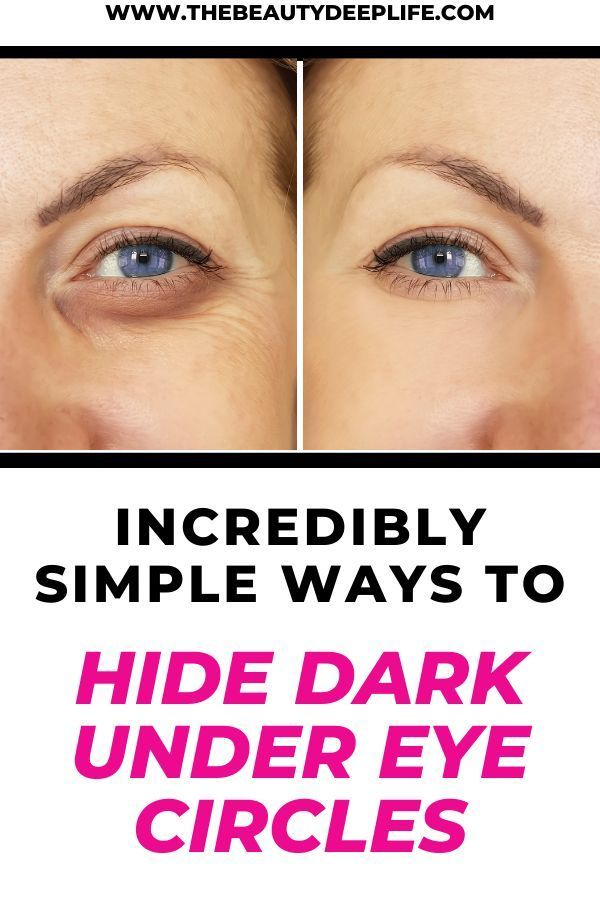 Incredibly Simple Ways To Hide Dark Under Eye Circles - The Beauty Deep Life - Incredibly Simple Ways To Hide Dark Under Eye Circles - The Beauty Deep Life -   9 beauty Tips for dark circles ideas