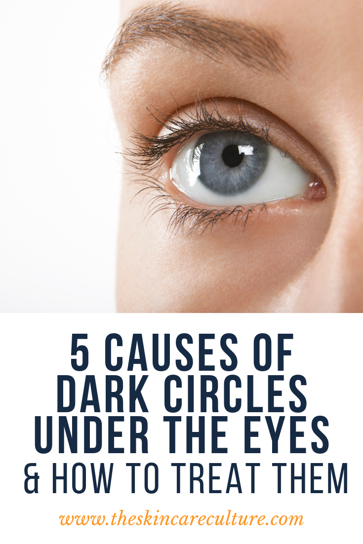 How To Get Rid Of Dark Circles Under The Eyes - How To Get Rid Of Dark Circles Under The Eyes -   9 beauty Tips for dark circles ideas