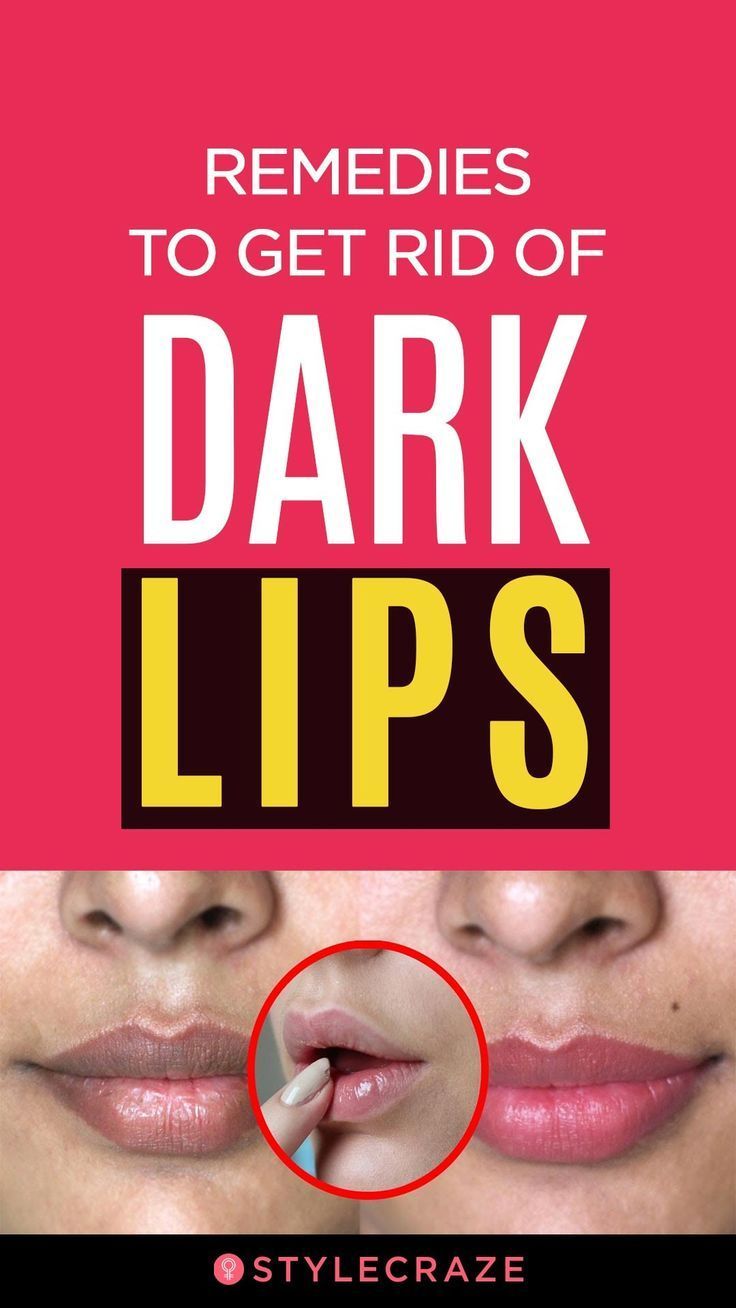 3 Remedies To Get Rid Of Dark Lips - 3 Remedies To Get Rid Of Dark Lips -   15 beauty Lips dark ideas