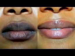 How to Lighten Dark Lips - How to Lighten Dark Lips -   15 beauty Lips dark ideas