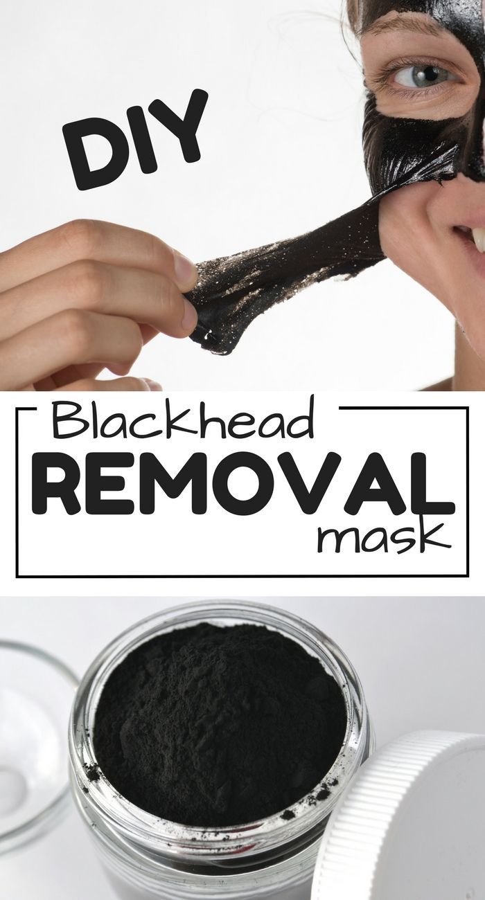 15 diy Face Mask black heads ideas