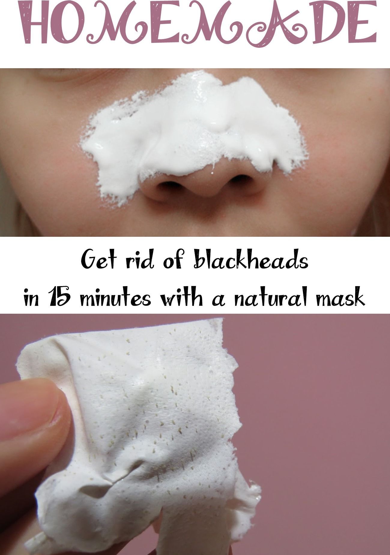 15 diy Face Mask black heads ideas