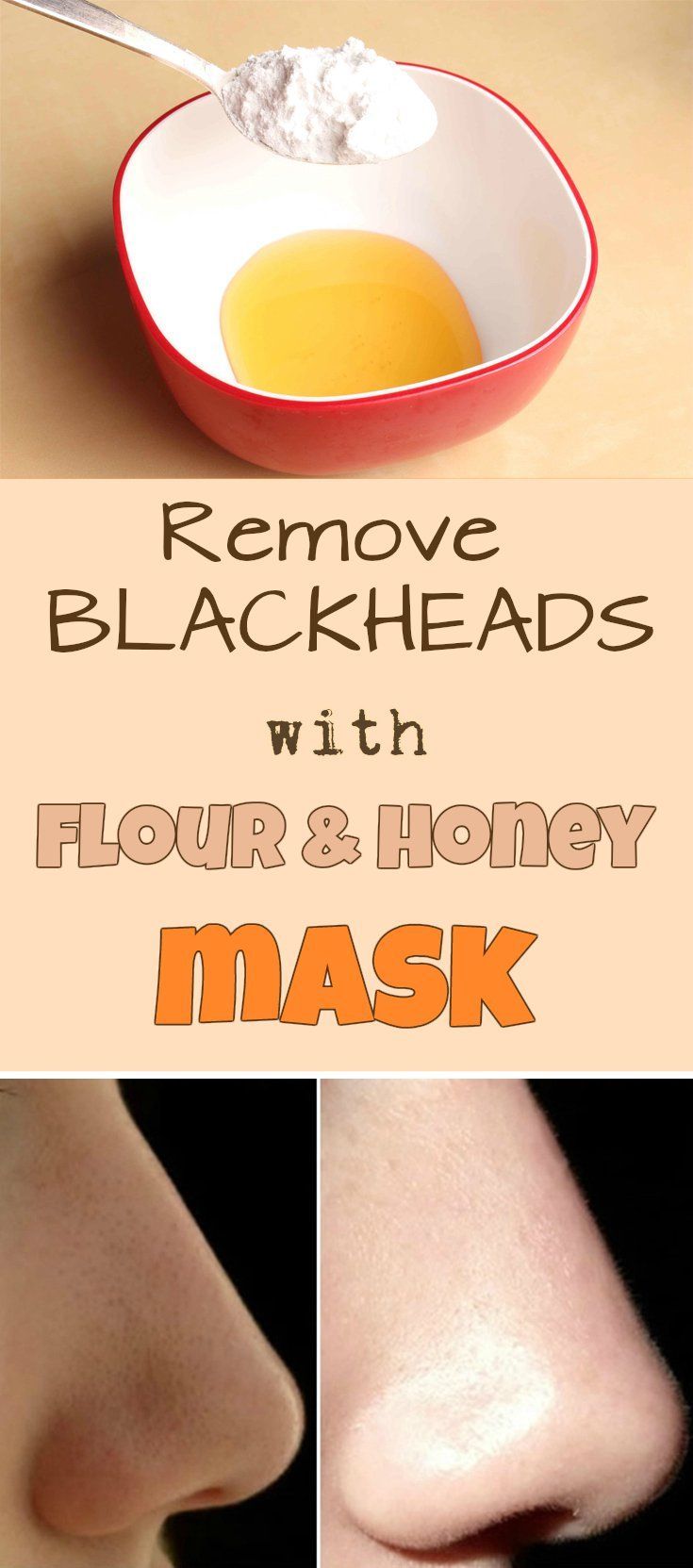 7 DIY Blackhead Remedies To Try At Home - 7 DIY Blackhead Remedies To Try At Home -   15 diy Face Mask black heads ideas