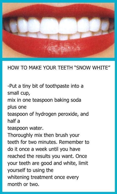 10 beauty Hacks teeth ideas