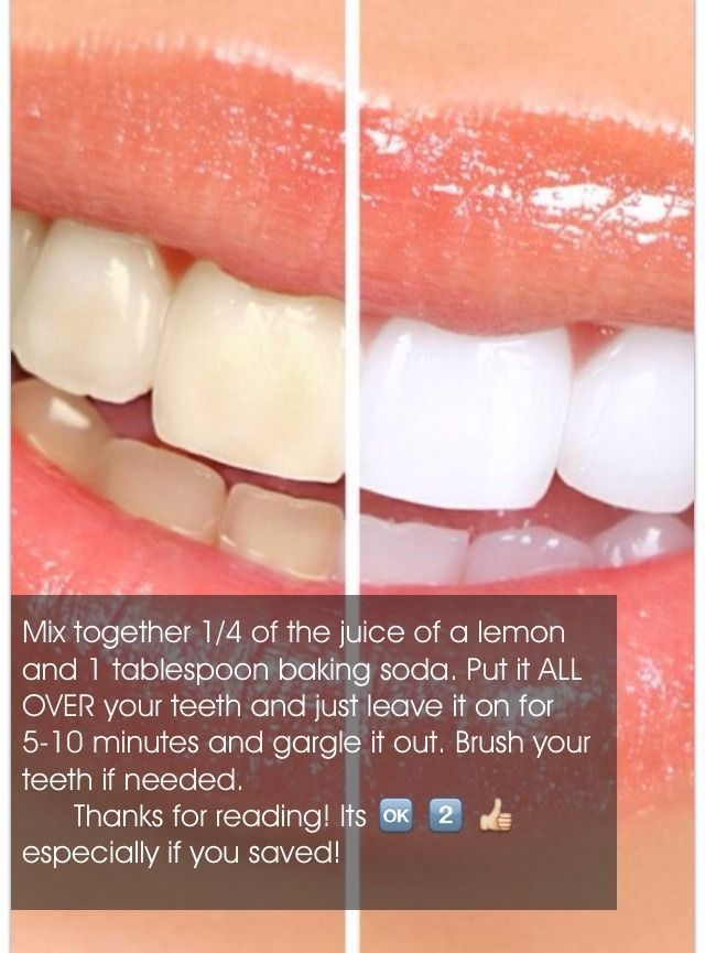 Teeth Whitener!? - Teeth Whitener!? -   10 beauty Hacks teeth ideas