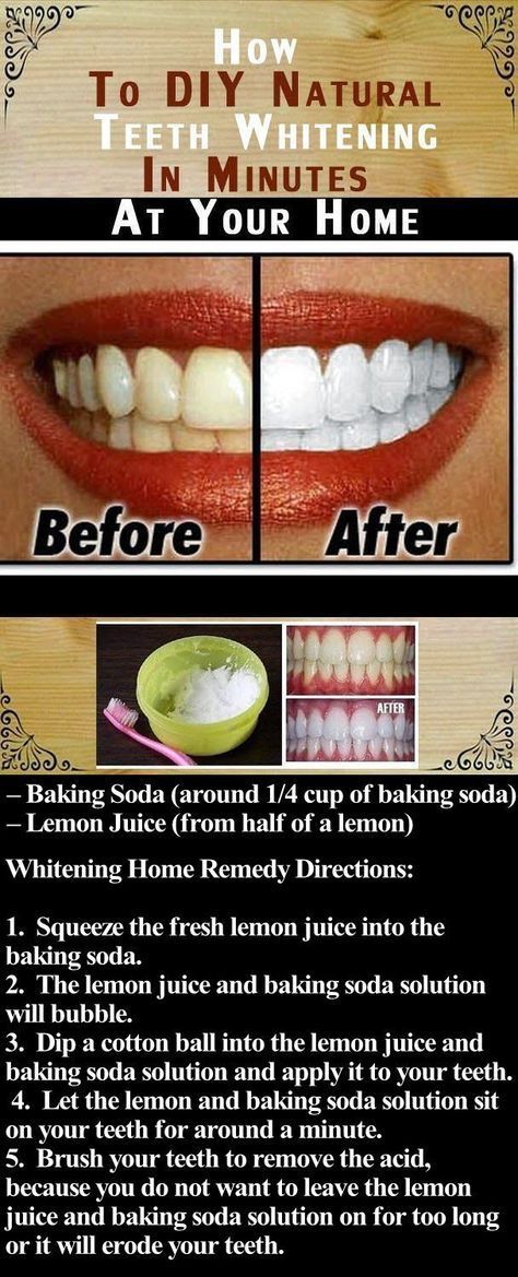 DIY Natural Teeth Whitening in Minutes At Your Home - DIY Natural Teeth Whitening in Minutes At Your Home -   10 beauty Hacks teeth ideas