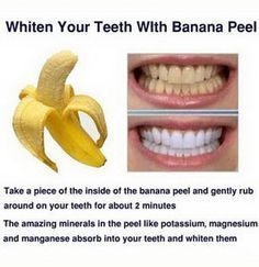 15 Natural Ways to Whiten Your Teeth: Homemade Teeth Whiteners 2017 - 15 Natural Ways to Whiten Your Teeth: Homemade Teeth Whiteners 2017 -   10 beauty Hacks teeth ideas