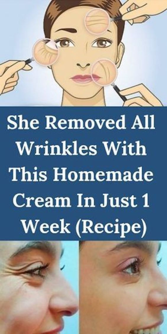 She Removed All Wrinkles With This Homemade Cream In Just 1 Week (Recipe) - She Removed All Wrinkles With This Homemade Cream In Just 1 Week (Recipe) -   17 how to get beauty Skin ideas