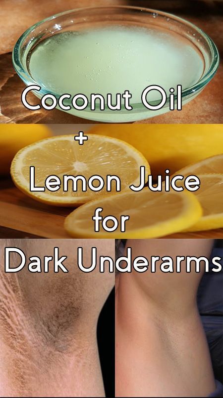 9 Incredible Coconut Oil Beauty Hacks - 9 Incredible Coconut Oil Beauty Hacks -   12 lemon beauty Hacks ideas
