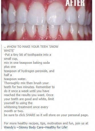 The best teeth whitening kits - The best teeth whitening kits -   13 beauty Tips for teeth ideas