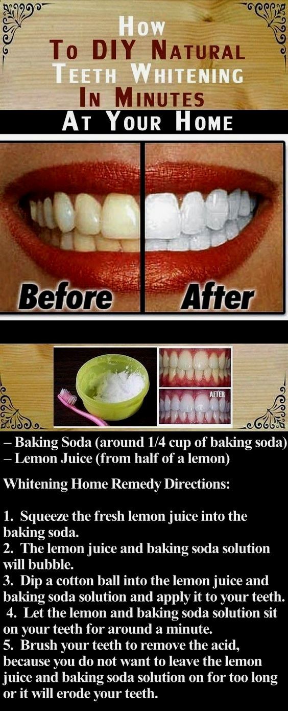 baking soda teeth damage - baking soda teeth damage -   13 beauty Tips for teeth ideas