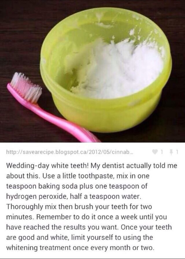 Wedding Day White Teeth! - Wedding Day White Teeth! -   13 beauty Tips for teeth ideas