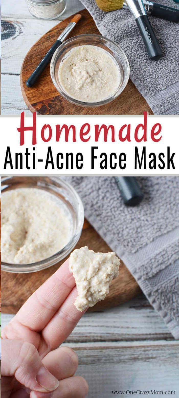 DIY Face Mask for Acne - Easy Homemade Face Mask for Acne - DIY Face Mask for Acne - Easy Homemade Face Mask for Acne -   15 diy Face Mask for pimples ideas
