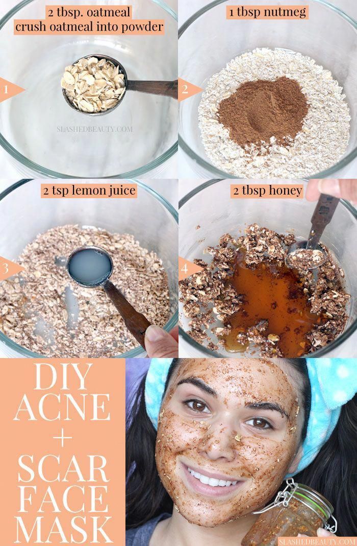 Best DIY Face Mask for Acne & Scars | Slashed Beauty - Best DIY Face Mask for Acne & Scars | Slashed Beauty -   15 diy Face Mask for pimples ideas