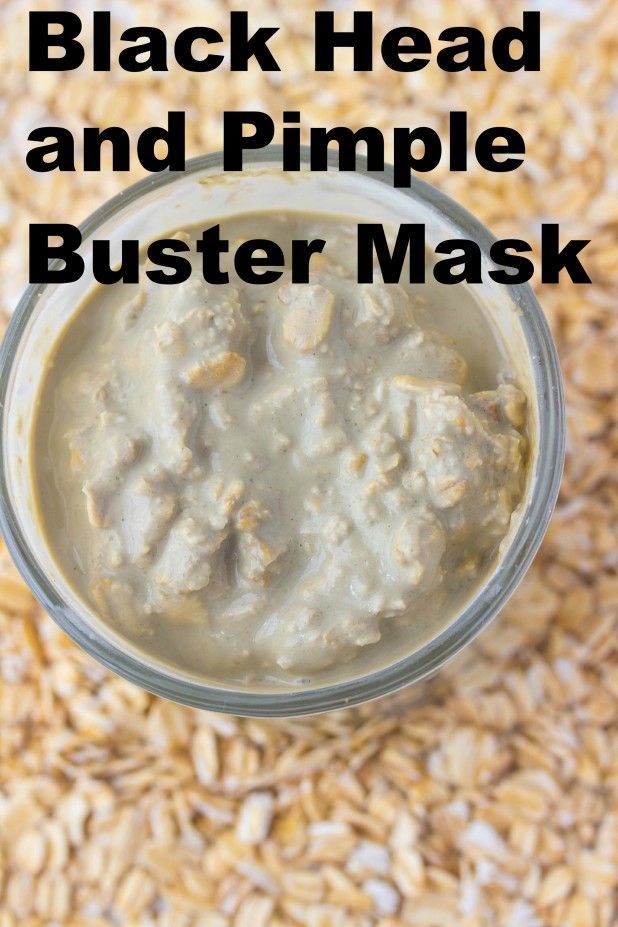 Black Head Buster Face Mask - Savvy Naturalista - Black Head Buster Face Mask - Savvy Naturalista -   15 diy Face Mask for pimples ideas
