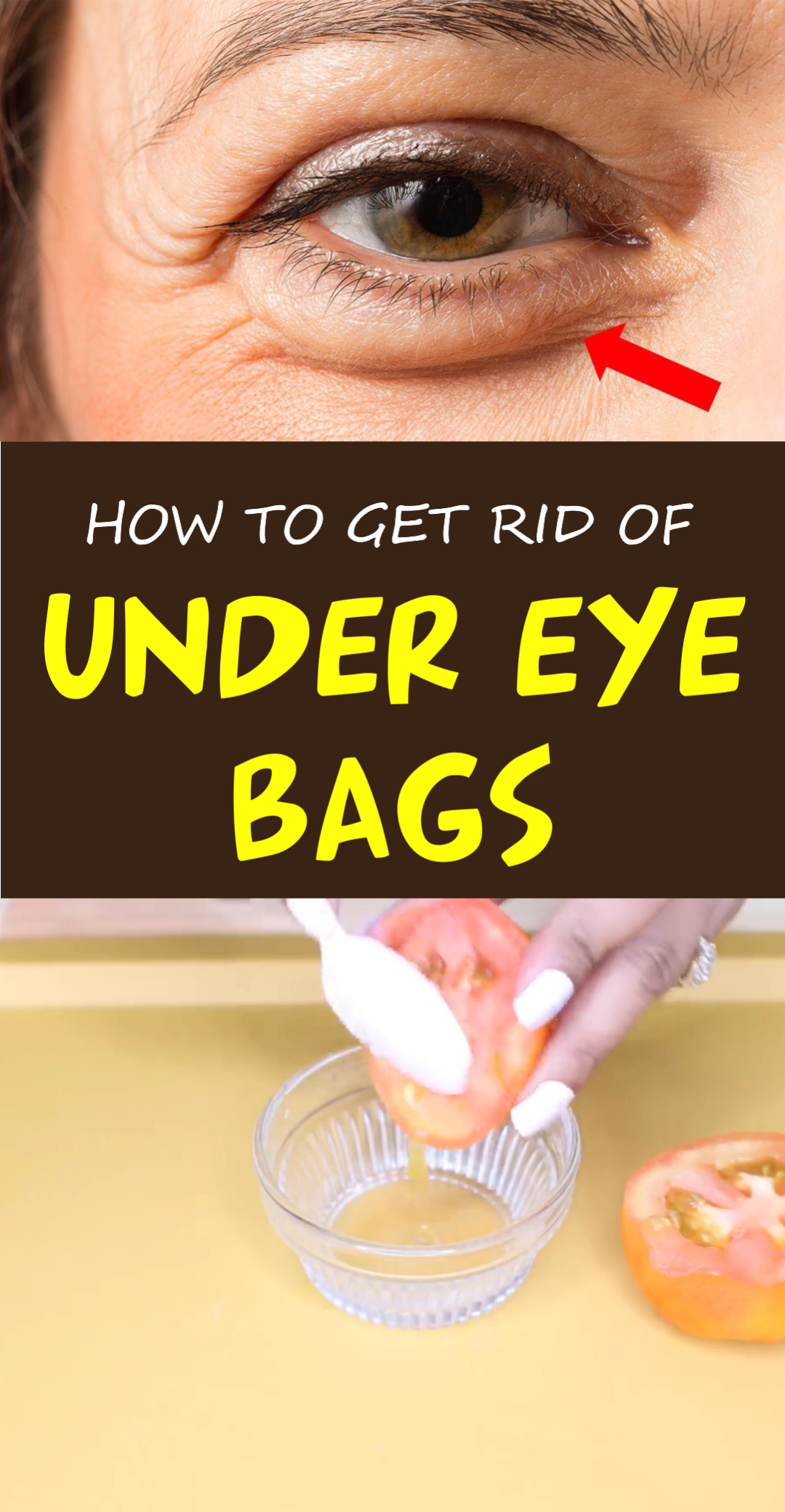 How to Get Rid of Dark Circles Under Your Eyes: Top 9 Home Remedies that Work - How to Get Rid of Dark Circles Under Your Eyes: Top 9 Home Remedies that Work -   18 beauty DIY hacks ideas