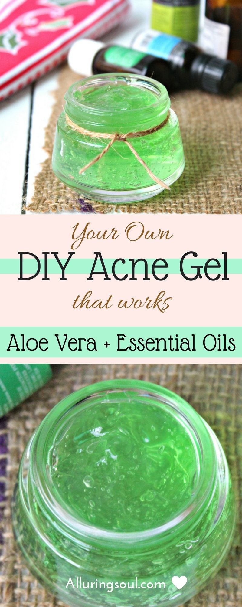 Your Own DIY Acne Gel That Works | Alluring Soul - Your Own DIY Acne Gel That Works | Alluring Soul -   18 diy Beauty nails ideas