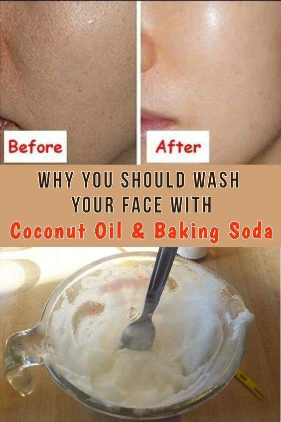 Baking Soda and Coconut Oil Face Mask - Baking Soda and Coconut Oil Face Mask -   19 diy Beauty coconut oil ideas