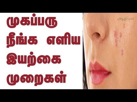 Pimples Cure in Tamil | Pimples Removal in Tamil |Tamil Beauty Tips - Pimples Cure in Tamil | Pimples Removal in Tamil |Tamil Beauty Tips -   11 beauty Tips in tamil ideas