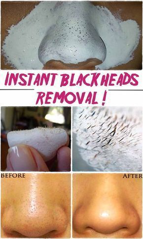 15 Amazing Beauty Hacks For Your Major Problem Areas - 15 Amazing Beauty Hacks For Your Major Problem Areas -   12 beauty Hacks amazing ideas