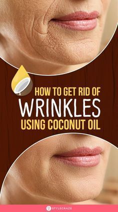 How To Get Rid Of Wrinkles Using Coconut Oil - How To Get Rid Of Wrinkles Using Coconut Oil -   17 beauty Care model ideas