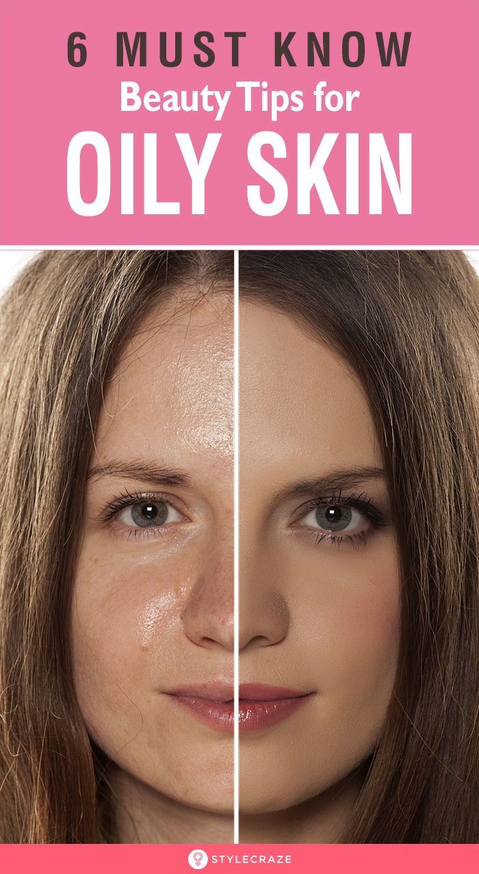 6 Must Know Beauty Tips for Oily Skin - 6 Must Know Beauty Tips for Oily Skin -   18 beauty tips ideas