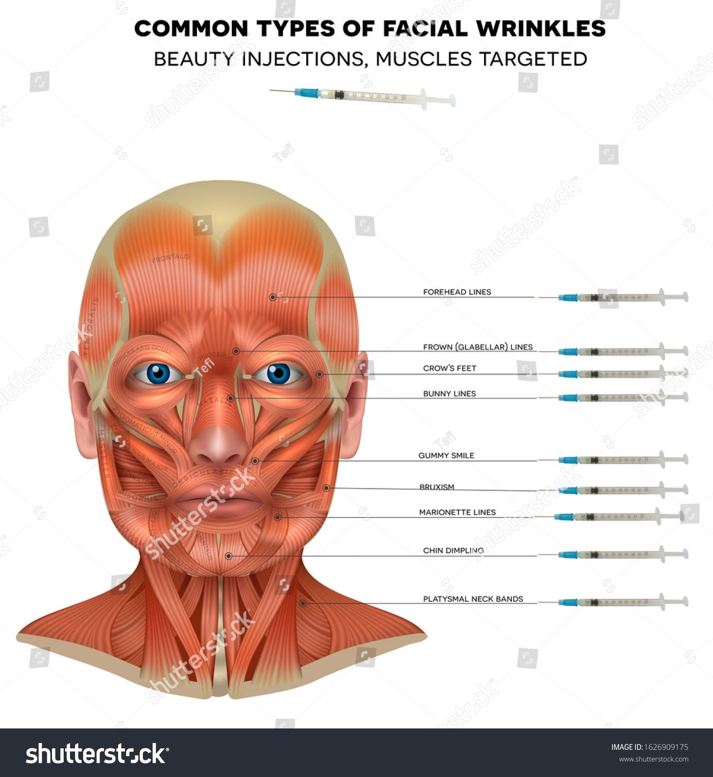 Common Types Facial Wrinkles Treatment Male Stock Vector (Royalty Free) 1626909175 - Common Types Facial Wrinkles Treatment Male Stock Vector (Royalty Free) 1626909175 -   12 beauty Treatments poster ideas