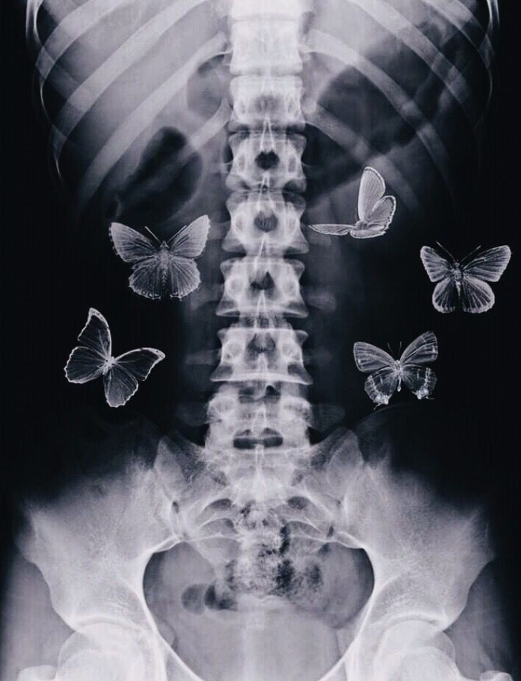 X-Ray Anticipatory Conceptual Butterflies Poster | Zazzle.com - X-Ray Anticipatory Conceptual Butterflies Poster | Zazzle.com -   15 edgy beauty Aesthetic ideas