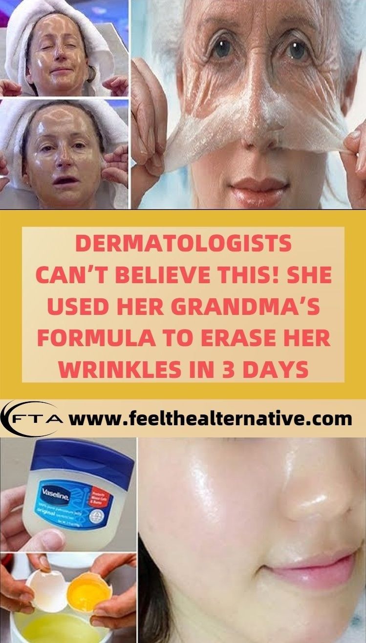 DERMATOLOGISTS CAN'T BELIEVE THIS! SHE USED HER GRANDMA'S FORMULA TO ERASE HER WRINKLES IN 3 DAYS - DERMATOLOGISTS CAN'T BELIEVE THIS! SHE USED HER GRANDMA'S FORMULA TO ERASE HER WRINKLES IN 3 DAYS -   17 beauty Tips for face ideas