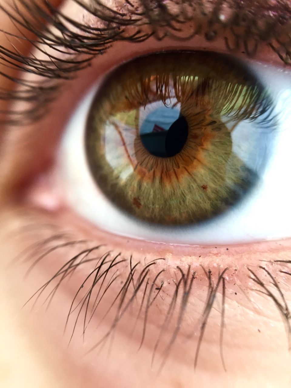 fuck yeah, heterochromia. - fuck yeah, heterochromia. -   13 beauty Eyes iris ideas