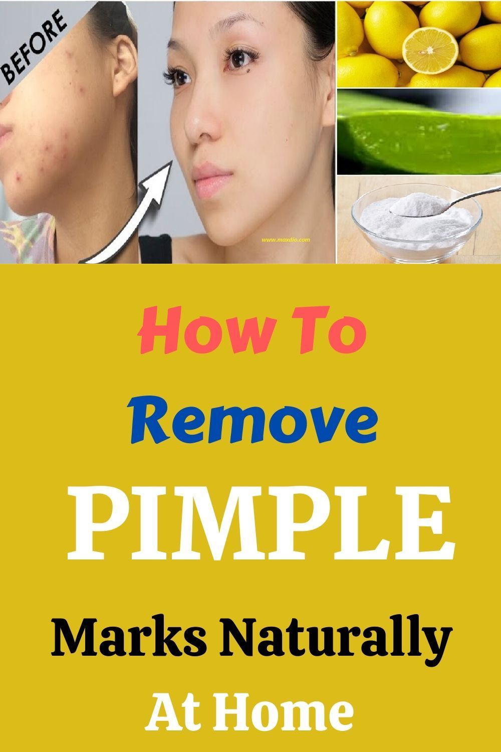 How To Remove Pimple Marks Naturally At Home - How To Remove Pimple Marks Naturally At Home -   18 beauty Treatments pimples ideas