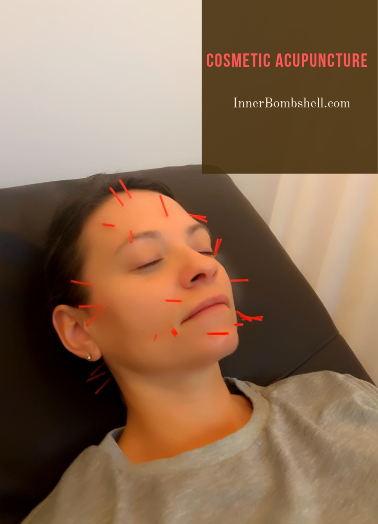 Cosmetic Acupuncture, Your New Favorite Beauty Treatment - - Cosmetic Acupuncture, Your New Favorite Beauty Treatment - -   18 medical beauty Treatments ideas