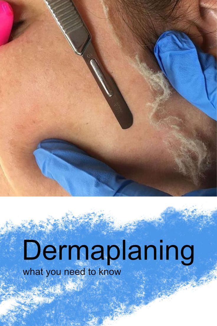 Dermaplaning - Everything You Need To Know - Dermaplaning - Everything You Need To Know -   18 medical beauty Treatments ideas