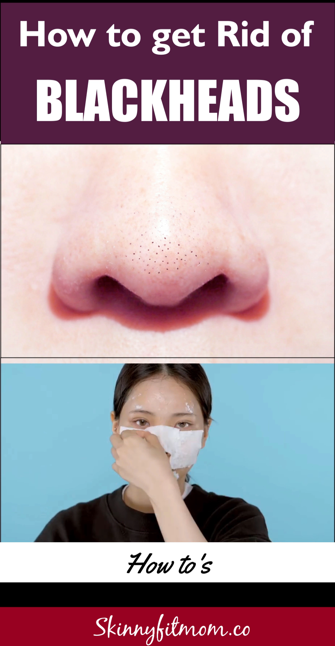 How to Remove Blackheads: The Best AT-Home Treatment - How to Remove Blackheads: The Best AT-Home Treatment -   18 simple beauty Hacks ideas