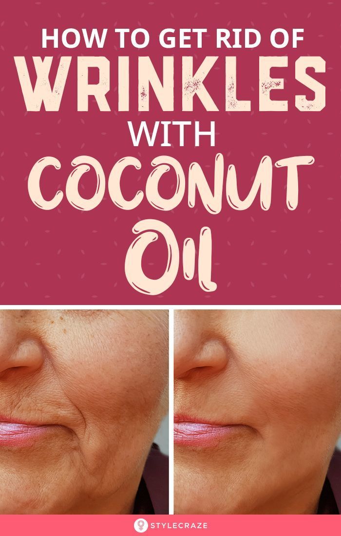 How To Get Rid Of Wrinkles Using Coconut Oil - How To Get Rid Of Wrinkles Using Coconut Oil -   19 beauty Treatments how to use ideas