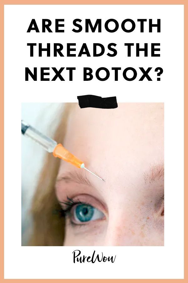Are Smooth Threads the Next Botox? Here's What You Need to Know About the Trending Treatment - Are Smooth Threads the Next Botox? Here's What You Need to Know About the Trending Treatment -   19 beauty Treatments how to use ideas