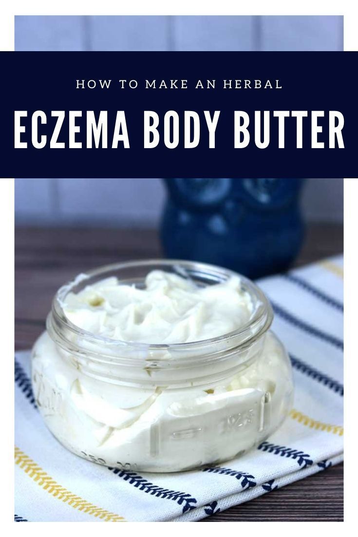 Homemade Eczema Body Butter With Aloe Vera - Homemade Eczema Body Butter With Aloe Vera -   19 diy Beauty easy ideas