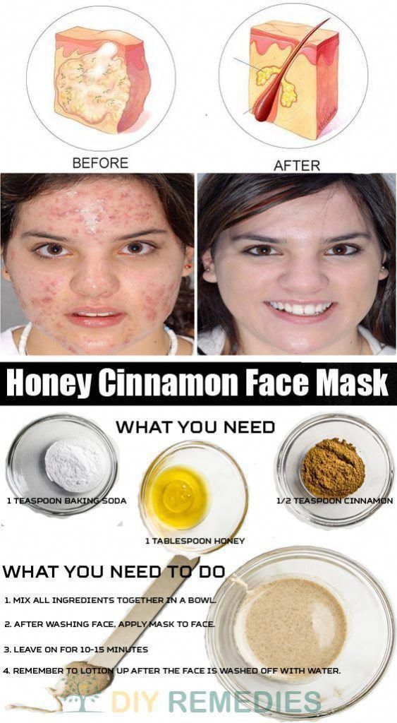 19 diy Face Mask cinnamon ideas