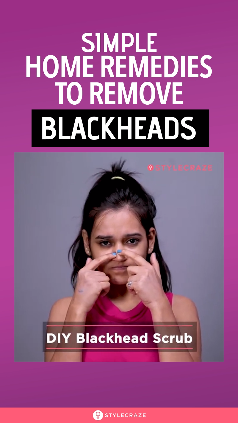 Simple Home Remedies To Remove Blackheads - Simple Home Remedies To Remove Blackheads -   19 top beauty Products ideas